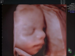 Hello Baby♪4D